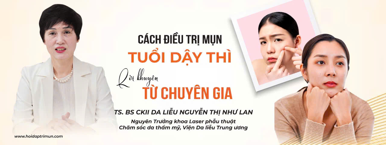 Banner trang chủ